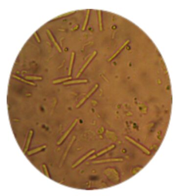 Avian Gastric Yeast (AGY) Megabacteria